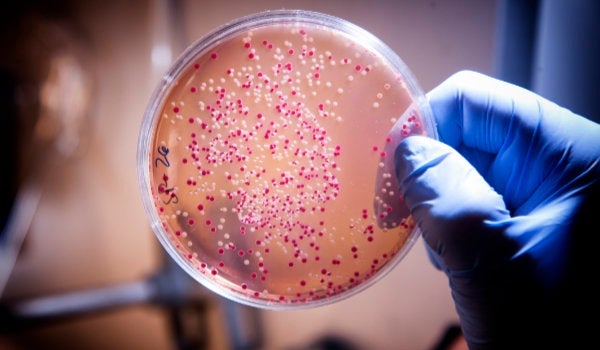 Gloved hand holding up a Petri dish with multicolored dots spread across the surface of the medium