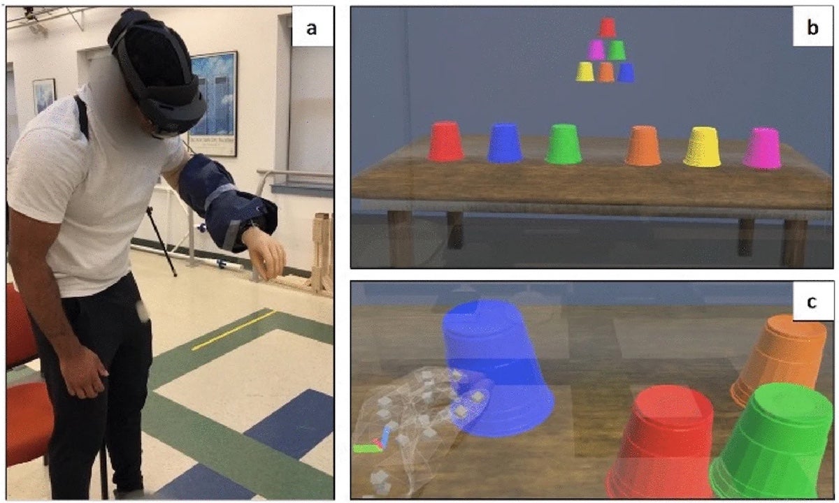 A participant in Susan D’Andrea’s study wears the bypass prosthesis and Microsoft HoloLens2 headset to play the augmented reality training game ARm-Strong. (URI photos/Susan D’Andrea)