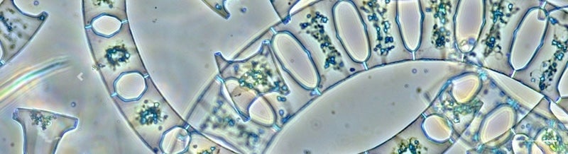 Microscopic close-up image of phytoplanton.