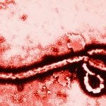 Ebola Virus at 108,000 Magnification