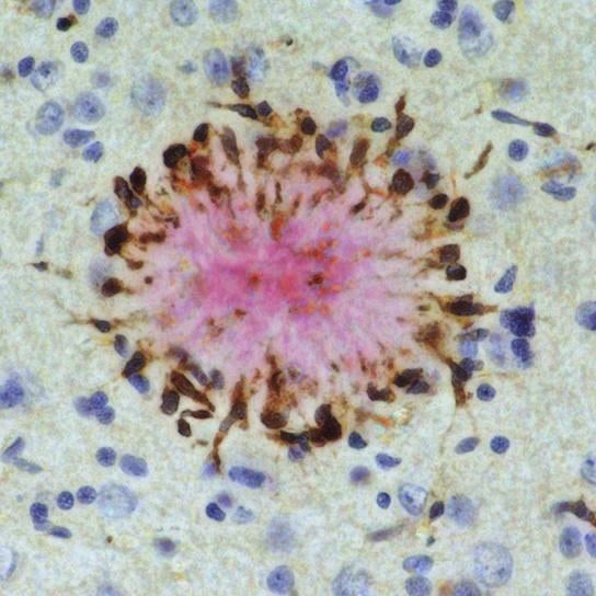 Additional brain health or neuroscience research image.