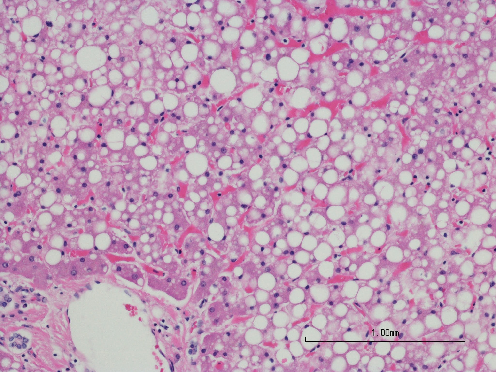 Additional image related to metabolism research or treatment outcomes.