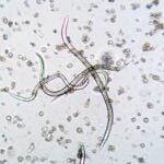 Nematodes like these seen under a microscope are key to Niall Howlett's research into Fanconi Anemia Neurological Syndrome.