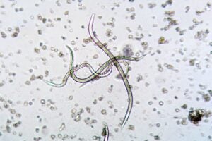 Nematodes like these seen under a microscope are key to Niall Howlett's research into Fanconi Anemia Neurological Syndrome.