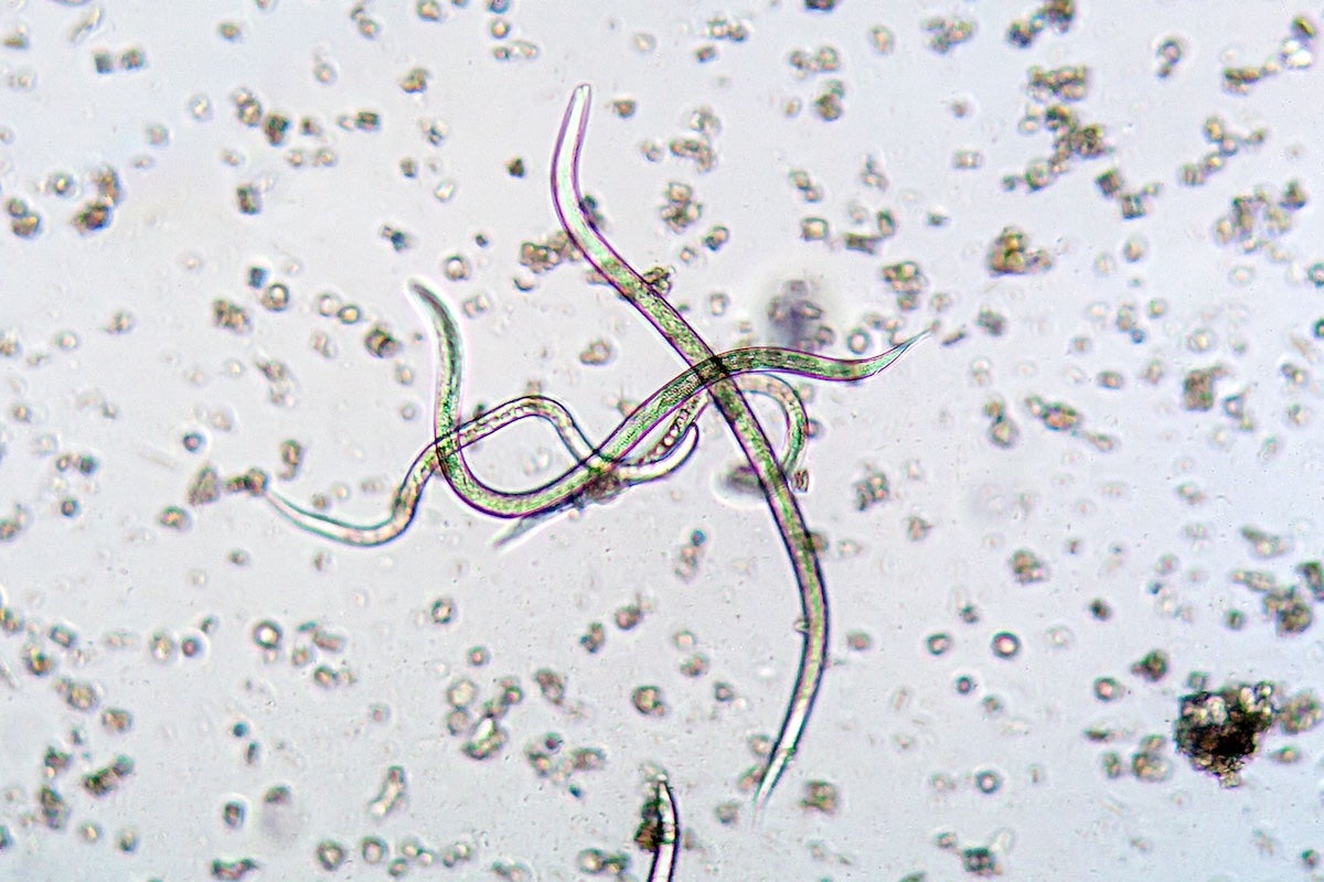 Nematodes like these seen under a microscope are key to Niall Howlett's research into Fanconi Anemia Neurological Syndrome.