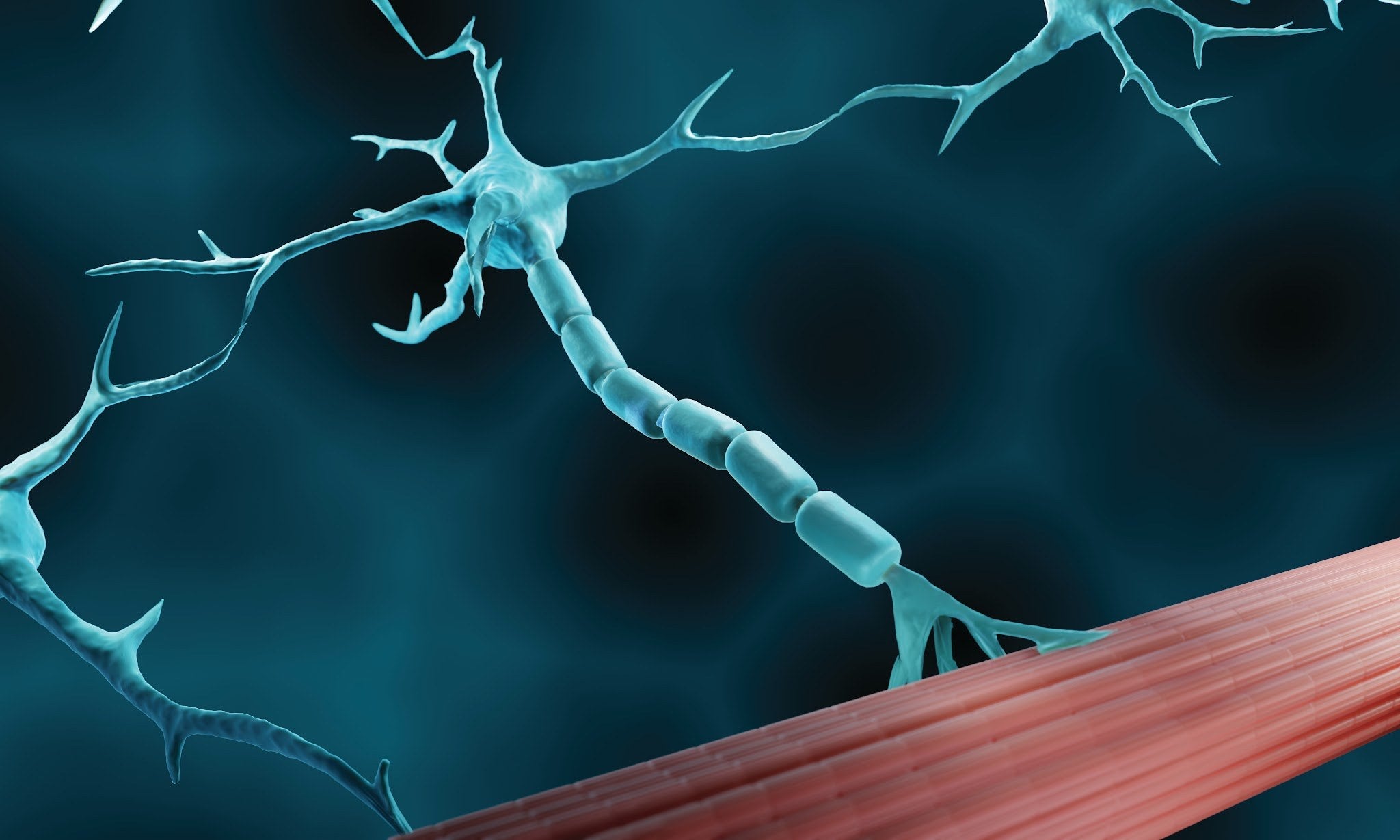 Additional image related to proprioception or cerebral palsy research.