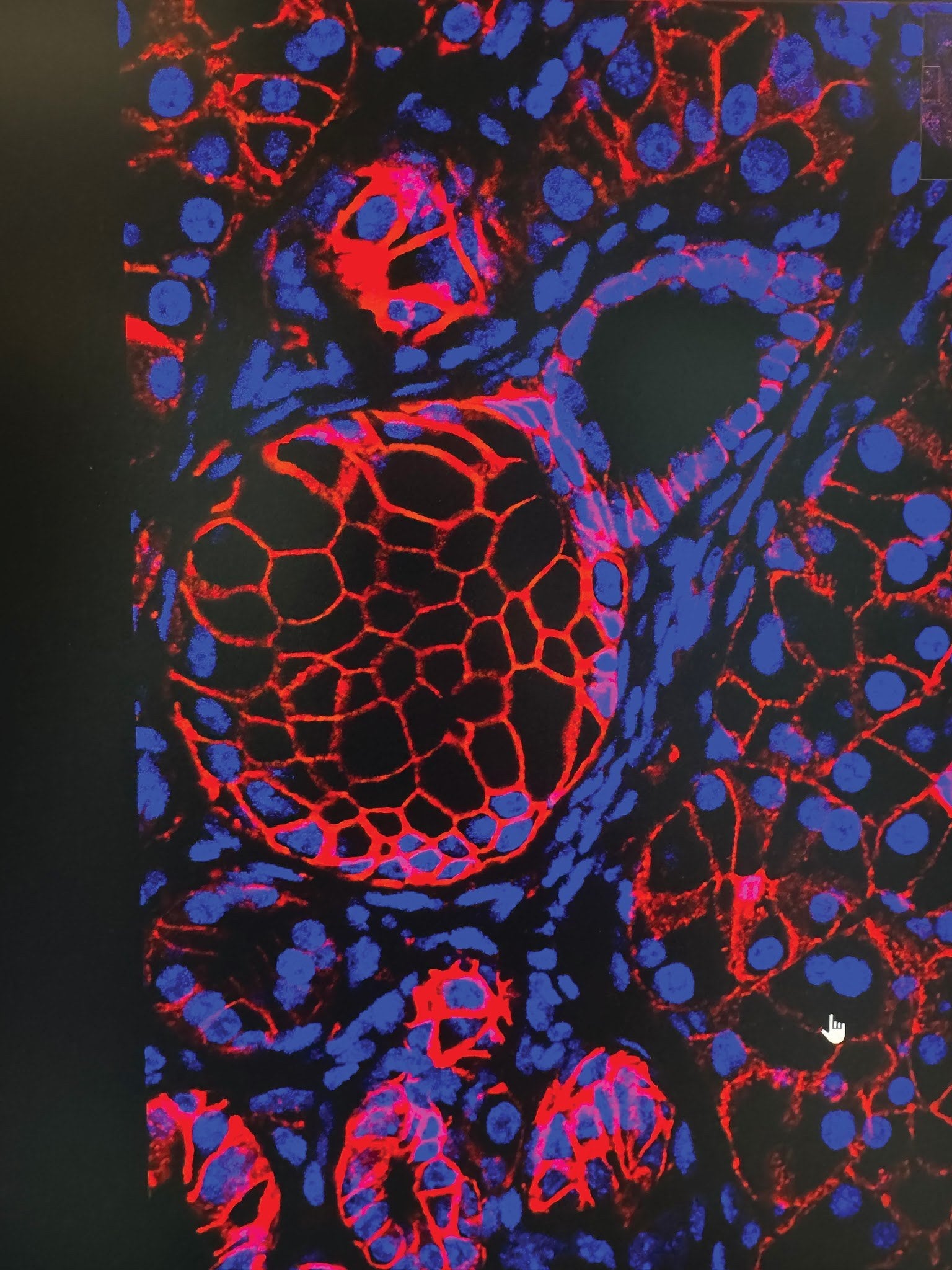 Additional image related to pancreatic cancer or engineered-bacteria research.