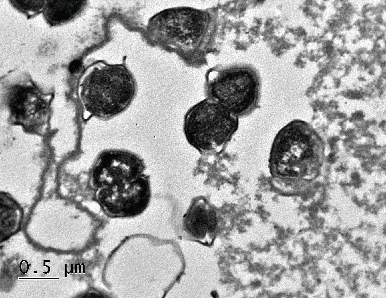 Additional image related to pancreatic cancer or engineered-bacteria research.