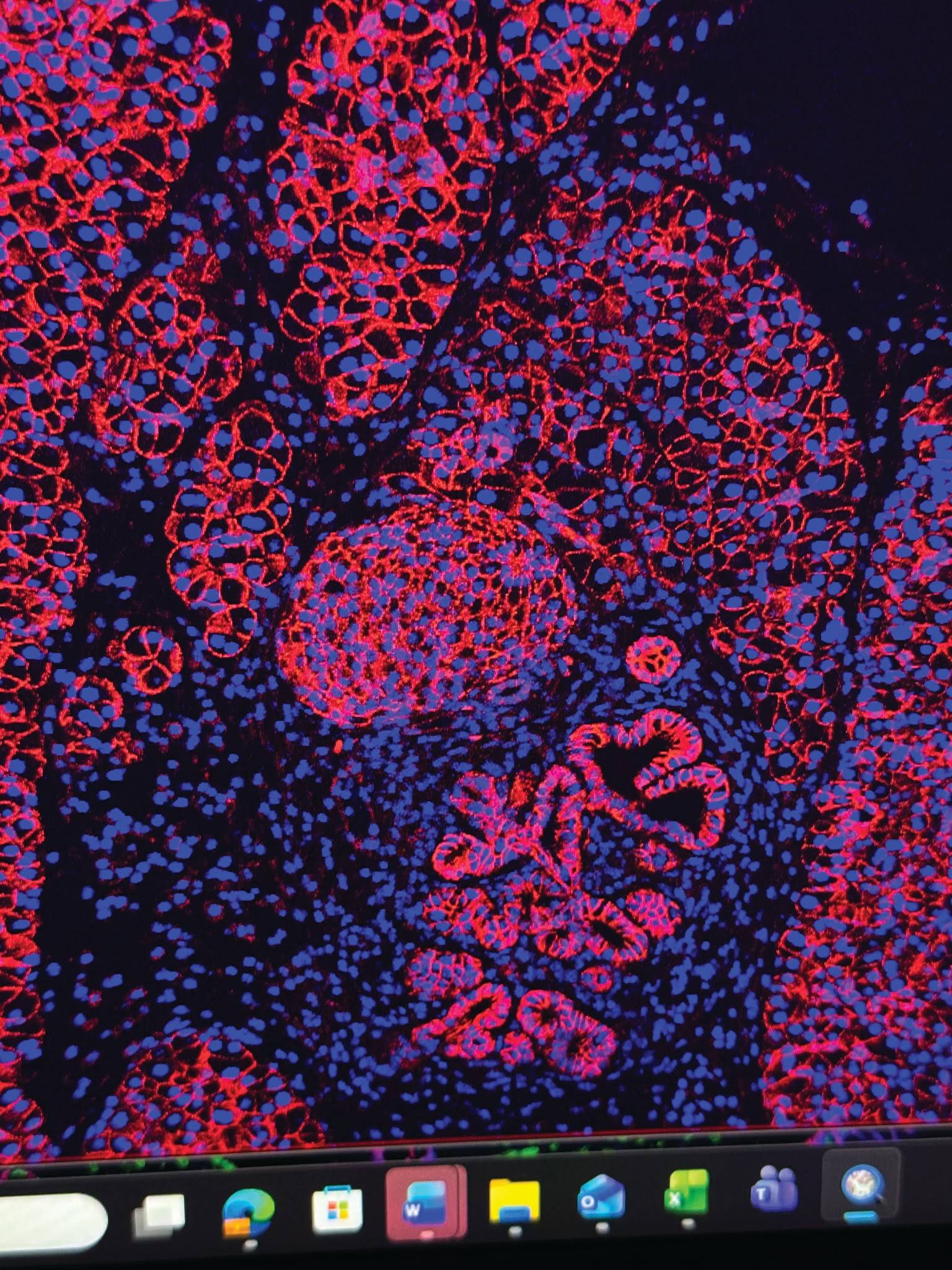 Additional image related to pancreatic cancer or engineered-bacteria research.