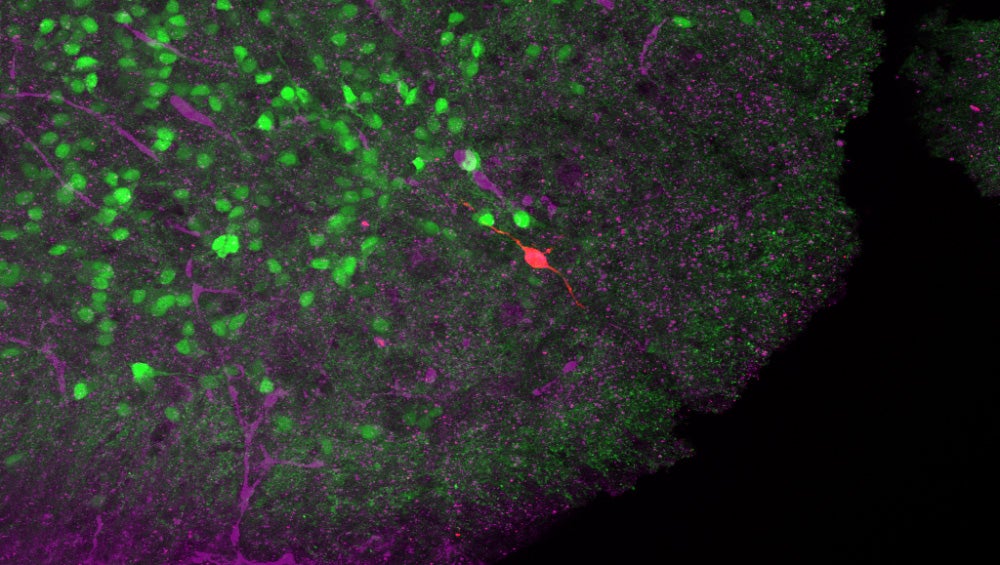 Neurological Connections