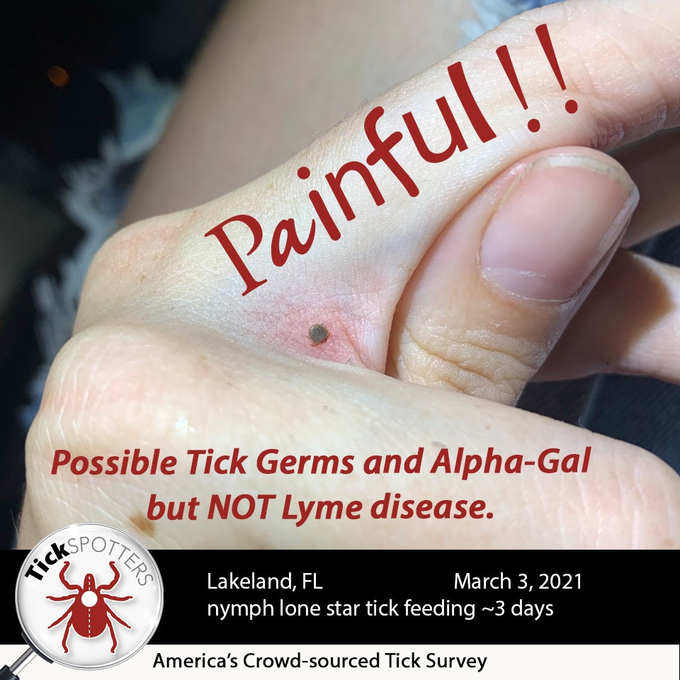 Lone Star Tick Social Media Meme