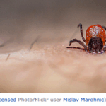 Blacklegged tick embedded in a human
