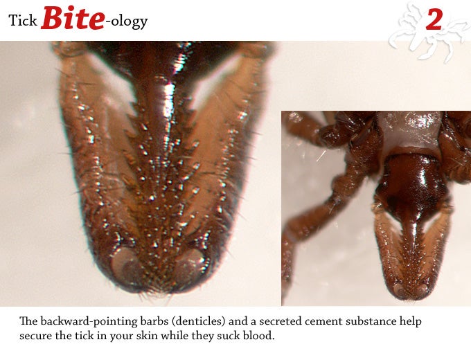 Tick Bite-ology – TickEncounter