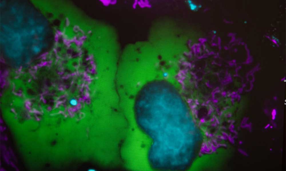 inbre program, cells