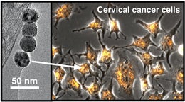 To right, nanoparticles glow yellow inside cervical cancer cells. To the left, higher magnification shows the magnetic nanoparticles themselves. They have a special lipid coating that contains polyethylene glycol ligands, creating tiny bumps on their surface. The ligands impart stealth properties that hide the particles from the immune system; they may also help protect any therapeutic cargo loaded onto the particles. 
