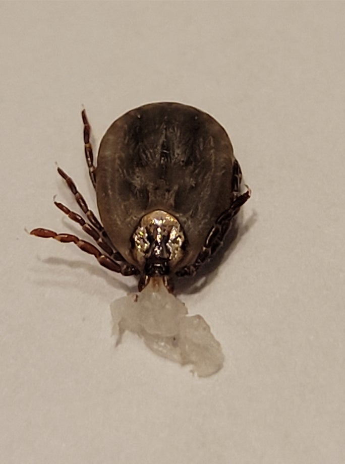 female American dog tick with a mouthful of skin