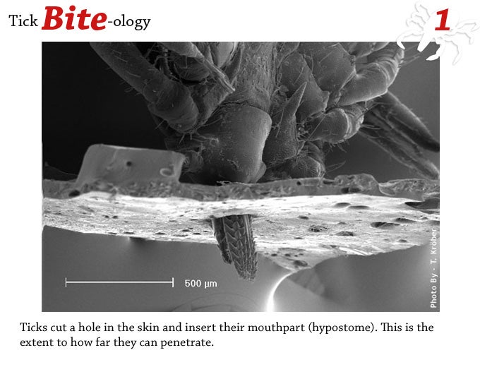 Microscopic view of ticks cut a hole in the skin and insert their mouthpart (hypostome). This is the extent of how far they can penetrate
