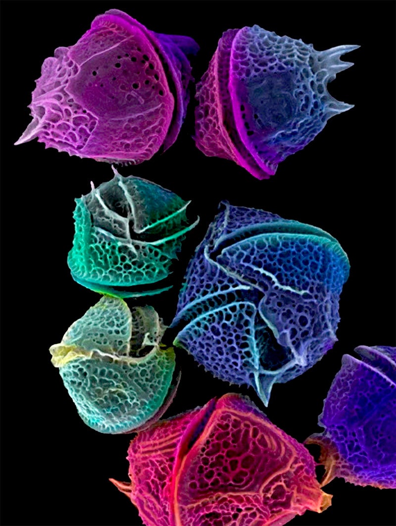 Colorized Electron Micrograph of Phytoplankton