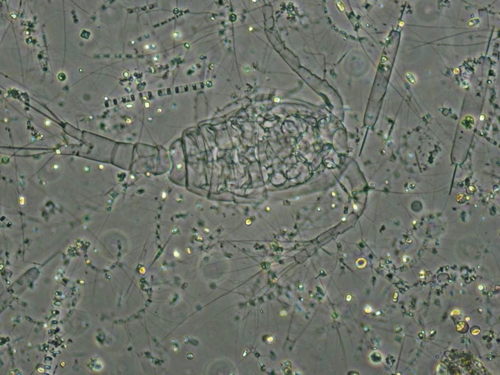 Photo of Acartia tonsa, and various phytoplankton, by Anna Mosby and Caitlyn Lawrence.