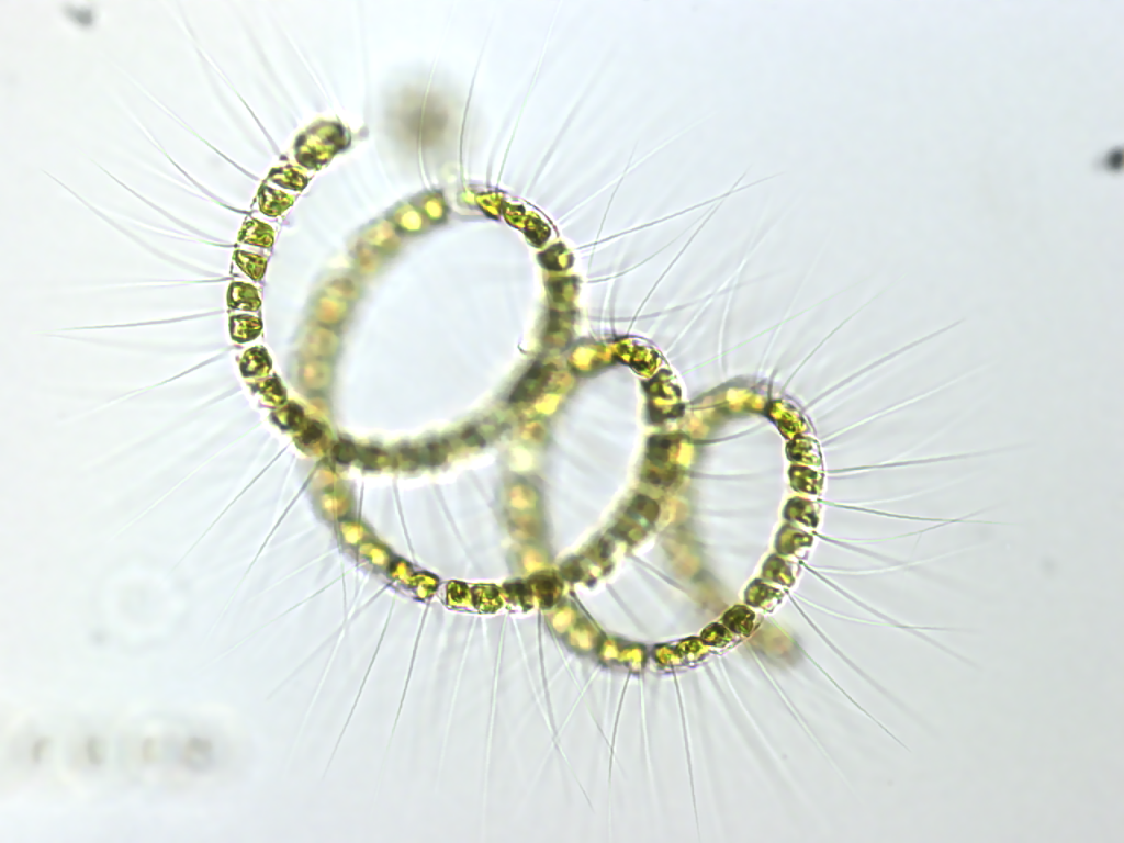 Photo of plankton Chaetoceros curvisetus, by Stephanie Anderson.