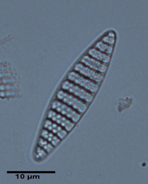 Photomicrograph of Fragilariopsis kerguelensis from the Sabrina Coast, light microscope 1000x.